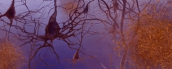 Alzheimers #30