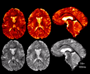 Mri #3