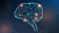 Brain #4
