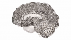 Alzheimer #54