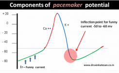 Pacemaker #2