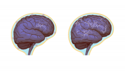 Brain #32