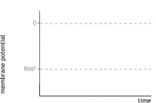 Ecg #4