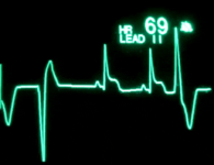 Ecg #2