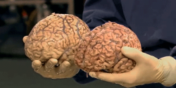 Brain #12