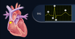 Cardiaca #2