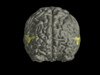 Brain #22
